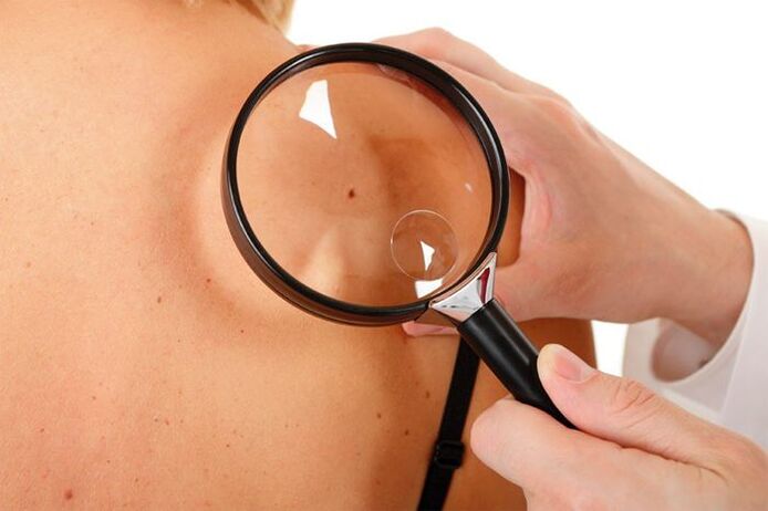 Patient testing with HPV