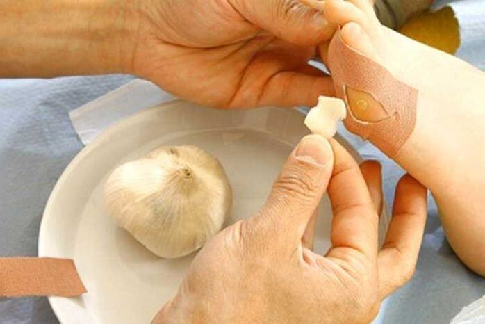 Treatment of papillomes with clistic compress